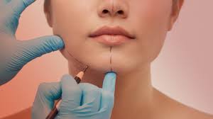 plastic surgery trends for 2023