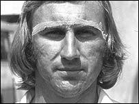 JOHN LEVER v INDIA 1976-77. John Lever wearing the gauze strips. 1st Test, Delhi 7-46, 3-24. 2nd Test, Calcutta 2-57, 0-12. 3rd Test, Madras 5-59, 2-18 - _42063272_lever203