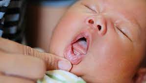 Apabila bayi menunjukkan gejala yang mengkhawatirkan, segera periksakan pada dokter ahli. Wajib Tahu Ini Ciri Ciri Dan Tanda Bayi Tumbuh Gigi