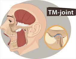 Extreme lockjaw pain unlocked fast (this works!!) Tmj Dysfunction How Your Jaw Works How It S Treated When It Doesn T North Carlton Osteopathy Caring For Every Body