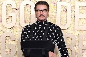 pedro pascal explains why his arm was