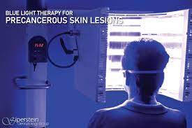precancerous skin lesions