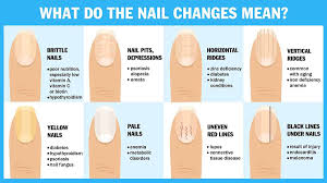 nail health chart how to identify problems