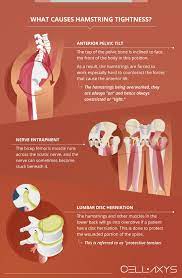 knee pain can tight hamstrings cause