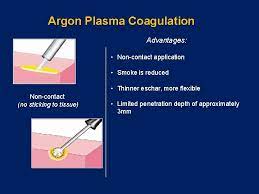 argon plasma coagulation theutic