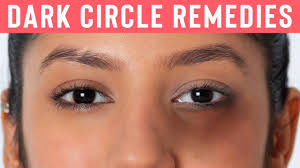 how to remove dark circles naturally