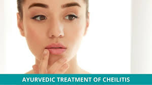 what is cheilitis and how to treat it