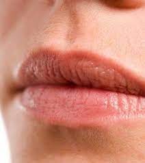 bleeding lips how to reduce the fine