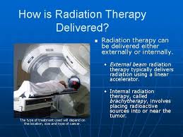 understanding radiation therapy for