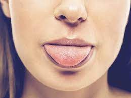 salty taste in mouth causes treatment