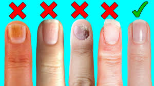 nails can say about your health