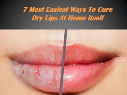 7 most easiest ways to cure dry lips at