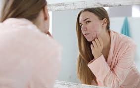 Papule, pustole, comedoni, cisti e fistole sono solo alcune delle più frequenti lesioni acneiche. Qual E La Miglior Dieta Anti Acne Consigli Pratici E Utili Recare Cosmetics