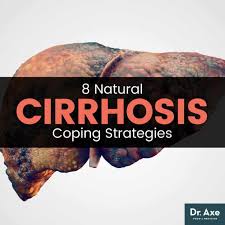 cirrhosis symptoms natural prevention