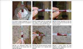 clot normally in plastic syringes
