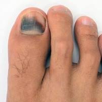 top podiatrist near me family foot and