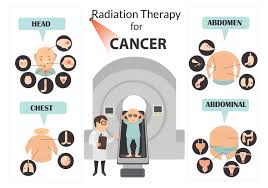 radiation therapy for cancer uses