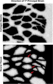 neural tissues of the lamina cribrosa