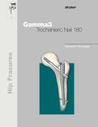 gamma3 trochanteric nail 180 operative