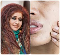 these skin care tips of shahnaz husain