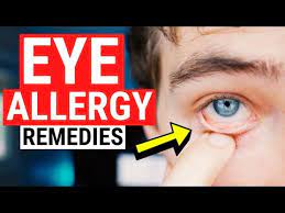 eye allergy remes tips for itchy