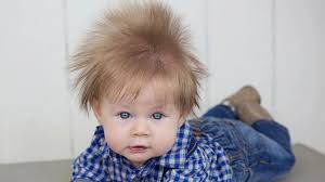 96 likes · 8 were here. 5 Month Old Baby Boy S Wild Hair Is The Mane Event Abc News