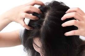 how do sports affect an itchy scalp