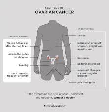 These symptoms can also be caused by a variety of other problems that have. Early Symptoms Of Ovarian Cancer What Does It Feel Like
