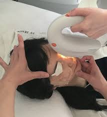 intense pulsed light therapy is