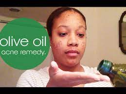 4 min olive oil acne remedy beat your