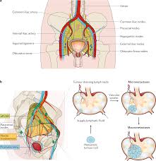 One in seven men in the united states will receive a prostate cancer diagnosis during his lifetime. Technologies For Image Guided Surgery For Managing Lymphatic Metastases In Prostate Cancer Nature Reviews Urology