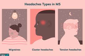 ms headaches symptoms causes