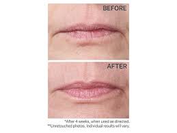strivectin double fix for lips plumping