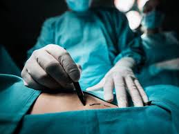 10 common plastic surgery complications