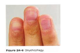 nail disorders and diseases flashcards
