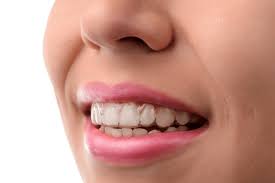 Mar 28, 2021 · to completely solve this problem, you can take the help of retainer brite tablets pills. How Do I Keep My Invisalign Clean American River Orthodontics