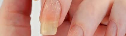 nail disorders total skin center