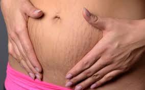 If you can grab a hair between your fingernails, it is long enough to be waxed off. Removing Your Pubic Hair For Labor