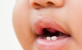Each day, using a clean finger, you can gently wiggle the loose tooth. Baby Teeth When Do They Come In Fall Out Crest