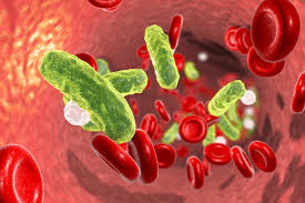 signs and symptoms of sepsis