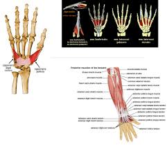 metacarpal fractures physiopedia