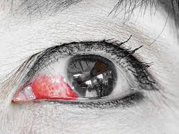 red eyes list of common causes
