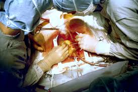 Image result for Open-heart surgery patients warned of bacterial infection risk