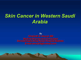 Contact email of director genaral in all foods items @gmail.com @hotmail.com. Skin Cancer In Western Saudi Arabia By Khalid M Al Aboud Md Khalid M Al Aboud Md Medical Director And Consultant Dermatologist King Faisal Hospital Makkah Ppt Download