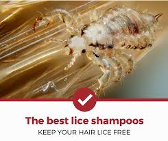 top 5 best lice shoos to now