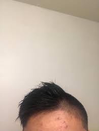 Comb over haircut styling tips from axe, the grooming expert. Barber Cut My Comb Over Too Far In The Middle Is There A Way Make This Somewhat Decent Malehairadvice