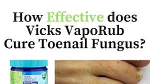 vicks vapor rub for toenail fungus