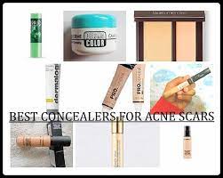 10 best concealers for acne scars and