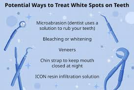 white spots on teeth causes treatment