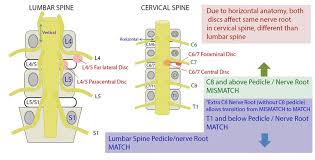 Neck Upper Extremity Spine Exam Spine Orthobullets
